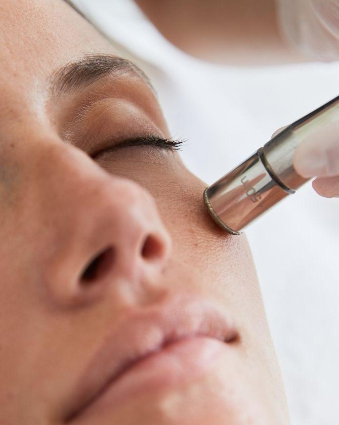 Microdermabración